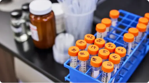 vials of lab samples